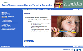 Screen caption of Fluoride information