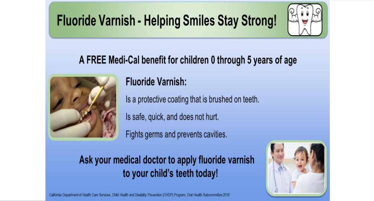 Fluoride Varnish Helping Smilies Stay Strong